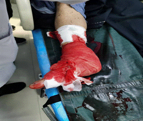 2022-01-09 17:20:48.719000